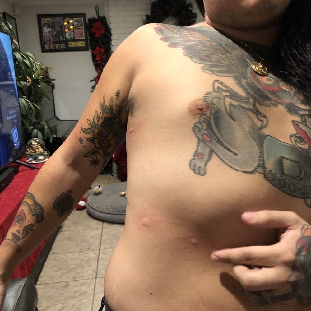 T's Nails & Spa - Mosquito bites all over the right side of my body! - Nail Salons Near Me - Stanton, California T's Nails & Spa - Mosquito bites all over the right side of my body! - Nail Salons Near Me - Stanton, California