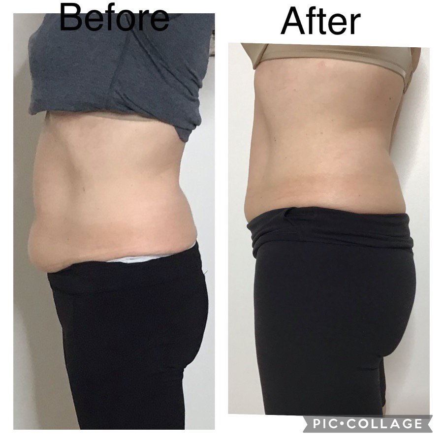 Bella Estetica Spa and Body Sculpting Logo