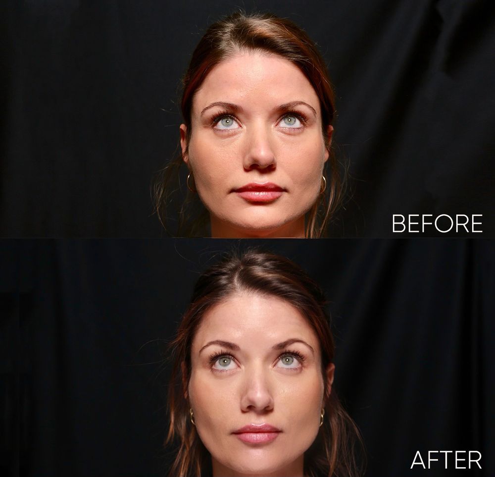 TAMPA LASER HAIR REMOVAL Updated September 2024 22 Photos 6739