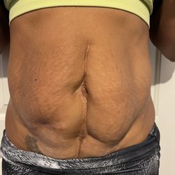 Farhad Rafizadeh, MD - Before surgery