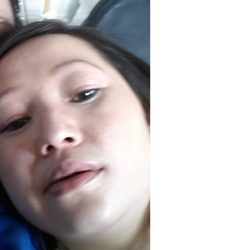 Woodbury Plastic Surgery - My face before any treatments from Woodbury Plastic Surgery.
