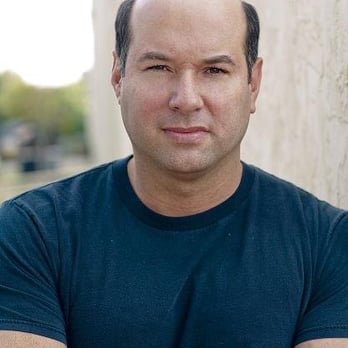 Amazing Hair Secrets - Before - Hair Loss Centers Near Me - San Diego, California Amazing Hair Secrets - Before - Hair Loss Centers Near Me - San Diego, California