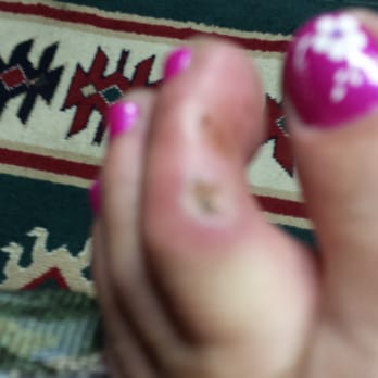 Nails Plus - This is what I got with my pedicure! She rubbed it til I was bleeding! Now m toe is infected! They are rude and over book people! - Nail Salons Near Me - Forest Grove, Oregon