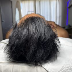 Lunadermspa - AFTER Hair Derive hair growth treatment