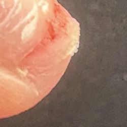 L&V Nails - This is what they did to my nails and proceeded to act clueless