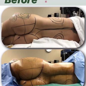 SoCal Plastic Surgeons - Plastic Surgeons Near Me - Newport Beach, California SoCal Plastic Surgeons - Plastic Surgeons Near Me - Newport Beach, California