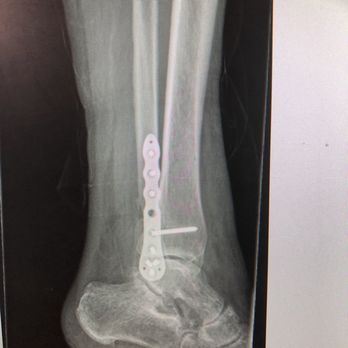 Mark M Mikhael, MD - Side view - Orthopedists Near Me - Burbank, California
