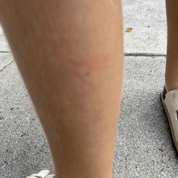 Gloss Time Salon - Marks on leg