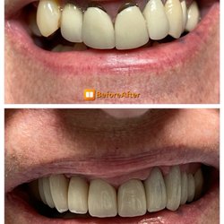 Daniel S. Guindi, DDS - New smile!