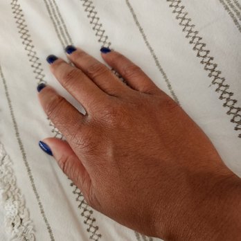 My Nails & Spa - My hand and wrist is swollen. - Nail Salons Near Me - Pittsburg, California My Nails & Spa - My hand and wrist is swollen. - Nail Salons Near Me - Pittsburg, California