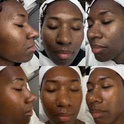 Unblemished Skin Studio