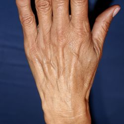 Rameen Moridzadeh, MD - Varicose Vein & Vascular Specialist