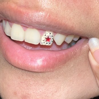 Cute Tooth - Teeth Whitening Near Me - San Diego, California