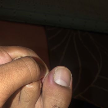 Violette Nails & Spa - Boyfriends toe for infected after pedicure. - Nail Salons Near Me - Rowland Heights, California