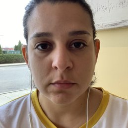 BEFORE lip fillers (definitely not happy) BEFORE lip fillers (definitely not happy)