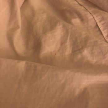 DoubleTree Suites by Hilton Hotel McAllen - Pulled the covers and see more lipstick stains, not to mention a tons of pubic hairs underneath when the lady pulled off this sheet! - Hotels Near Me - Mcallen, Texas DoubleTree Suites by Hilton Hotel McAllen - Pulled the covers and see more lipstick stains, not to mention a tons of pubic hairs underneath when the lady pulled off this sheet! - Hotels Near Me - Mcallen, Texas