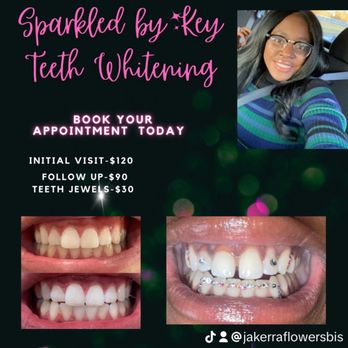 Sparkled By Key - Teeth Whitening Near Me