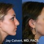 Photo of Dr Jay Calvert Plastic Surgery