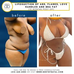Batal Plastic Surgery