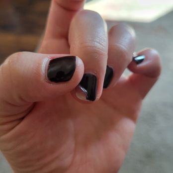 BB Nail Salon & Spa - The first nail that started peeling back on 2/21 and is half gone now. - Hair Removal Near Me - Grove City, Ohio BB Nail Salon & Spa - The first nail that started peeling back on 2/21 and is half gone now. - Hair Removal Near Me - Grove City, Ohio