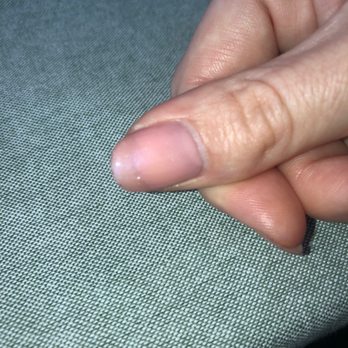 Iris Nails & Spa - Some discoloration on my nail - Nail Salons Near Me - Germantown, Maryland