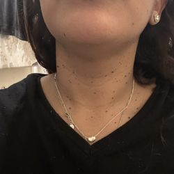 Beautiolic Beauty Bar - Skin tags before procedure