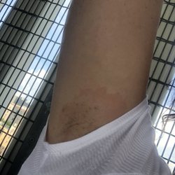 Tommy's Wax Center - Arm pits after wax