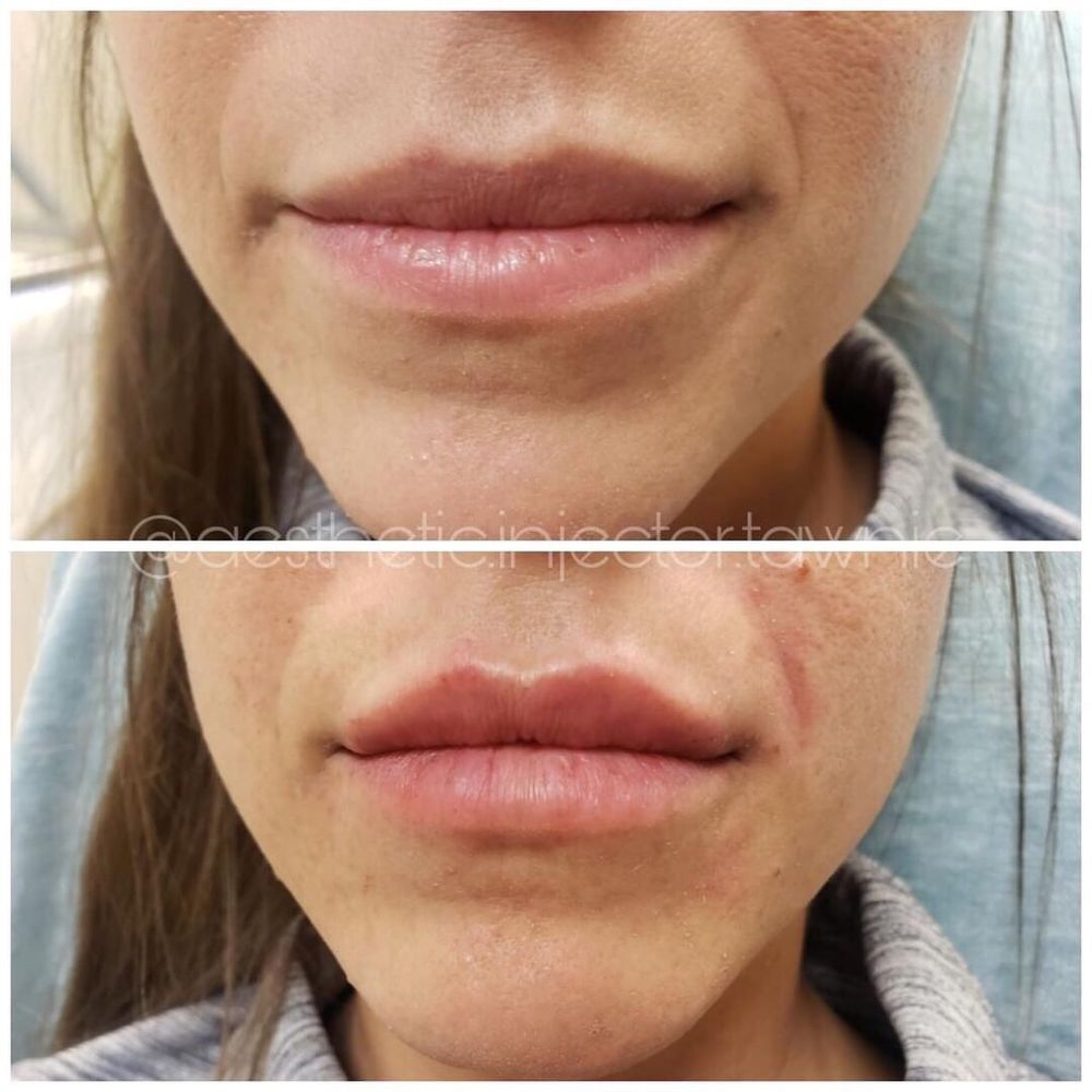 Before and after!! Before and after!!