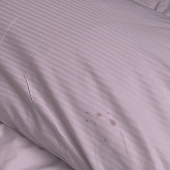 Mercure Sydney - Stained pillow case - Hotels Near Me - Sydney, NSW Mercure Sydney - Stained pillow case - Hotels Near Me - Sydney, NSW
