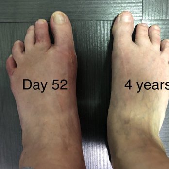 Liddy Podiatry & Prevention - My feet! - Podiatrists Near Me - Beverly Hills, California Liddy Podiatry & Prevention - My feet! - Podiatrists Near Me - Beverly Hills, California