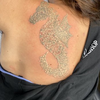 1 Point Tattoo - Just done. More treatments to go! - Tattoo Near Me - Kailua, Hawaii