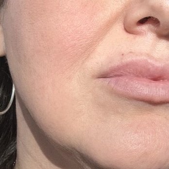 Integrative Beauty Plus - After Matis and lasers. - Skin Care Near Me