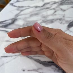 Bleeding cuticle
