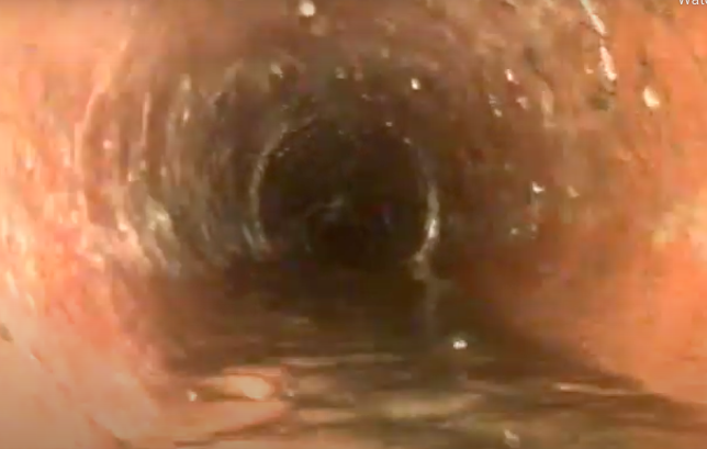 Slide of Spokane Rooter