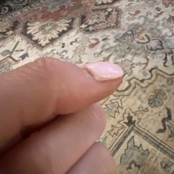 V Nails - My "fixed" thumb