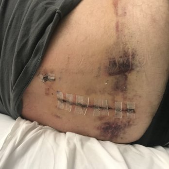 J. Rafe Sales, MD - Back surgery 2019 - Spine Surgeons Near Me - Portland, Oregon J. Rafe Sales, MD - Back surgery 2019 - Spine Surgeons Near Me - Portland, Oregon