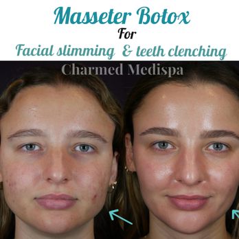 Charmed Medispa - Medical Spas Near Me - Newark, Delaware Charmed Medispa - Medical Spas Near Me - Newark, Delaware