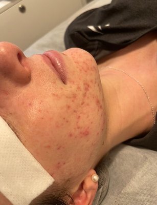 Acne Institute by null