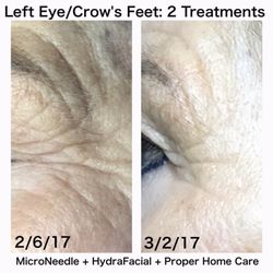 Bella Skin Care Pros - Actual Client