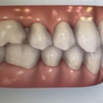 210 Orthodontics - Side view - Orthodontists Near Me - San Antonio, Texas 210 Orthodontics - Side view - Orthodontists Near Me - San Antonio, Texas