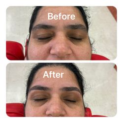 Heaven Beauty Spot - Reshape before and after