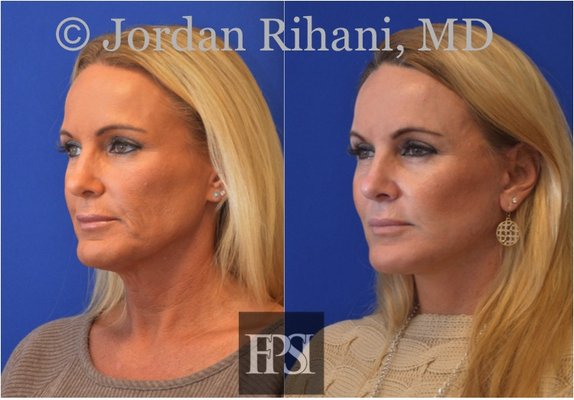 FACIAL PLASTIC SURGERY INSTITUTE - Updated August 2024 - 17 Photos & 10
