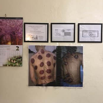 Pasadena Acupuncture and Foot Reflexology - Beauty & Spas Near Me - Pasadena, California Pasadena Acupuncture and Foot Reflexology - Beauty & Spas Near Me - Pasadena, California