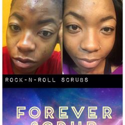 Rock & Roll Body & Soul - Two weeks after using FOREVER SCRUB.