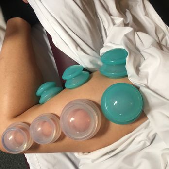 Creative Massage Therapy - Silicone Cupping - Massage Near Me Creative Massage Therapy - Silicone Cupping - Massage Near Me