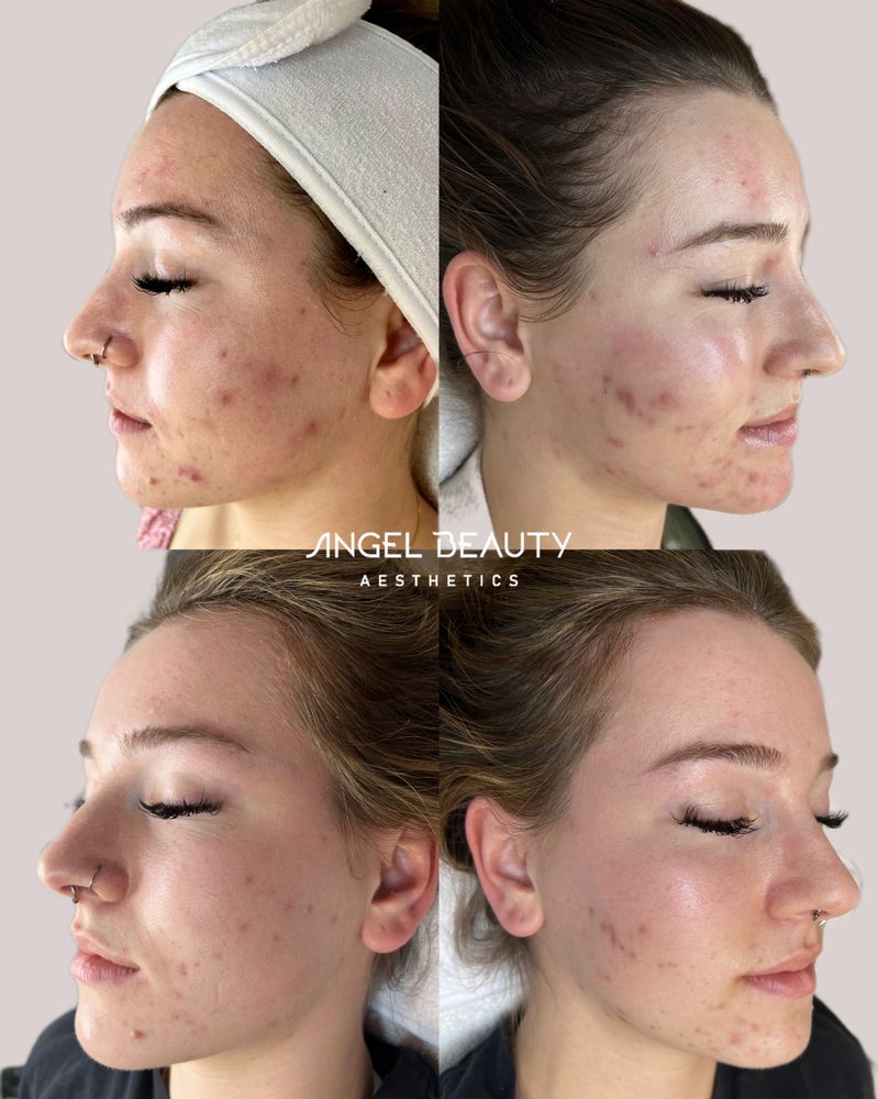 Angel Beauty Aesthetics Logo
