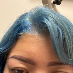 LasikPlus - New eyeballs lol