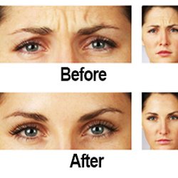 Serenity Med Spa - Soften lines with Botox or Dysport!