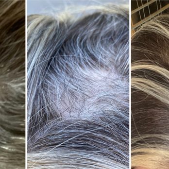 Dubrule Hair Innovation Center - Hair growth in stages over 4 months - Hair Loss Centers Near Me - Vancouver, British Columbia