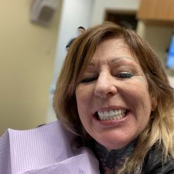 Affordable Dentures & Implants - Final implants